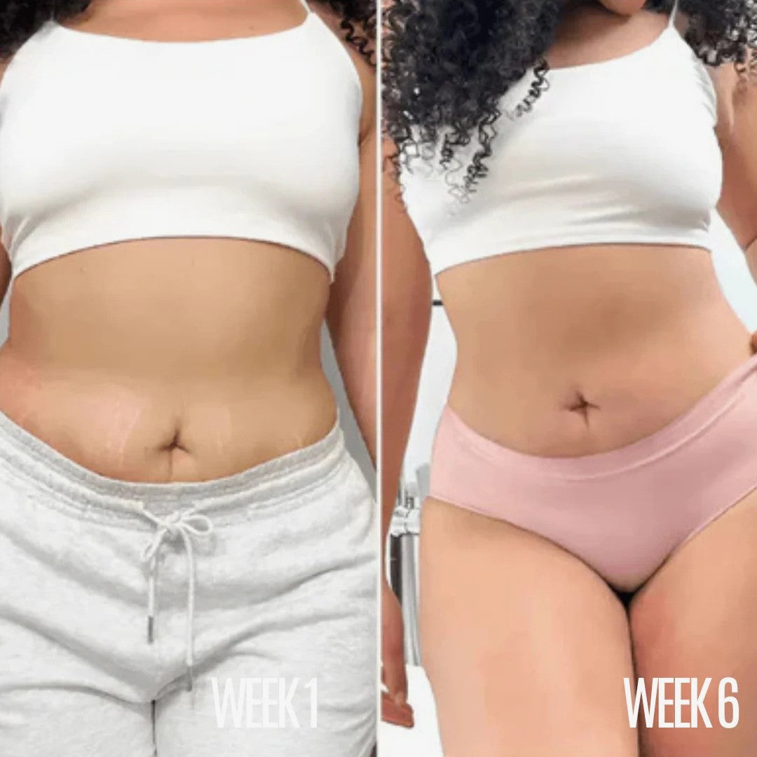 Lumea™ 3.0 At-Home Body Sculpting Kit