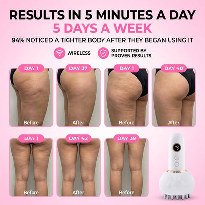 Lumea™ 3.0 At-Home Cellulite & Lymphatic Drainage Kit